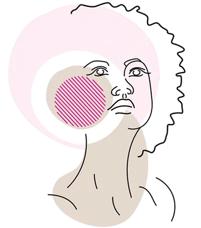 Hyperpigmentation
